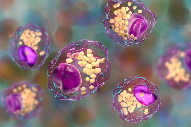 lipemia