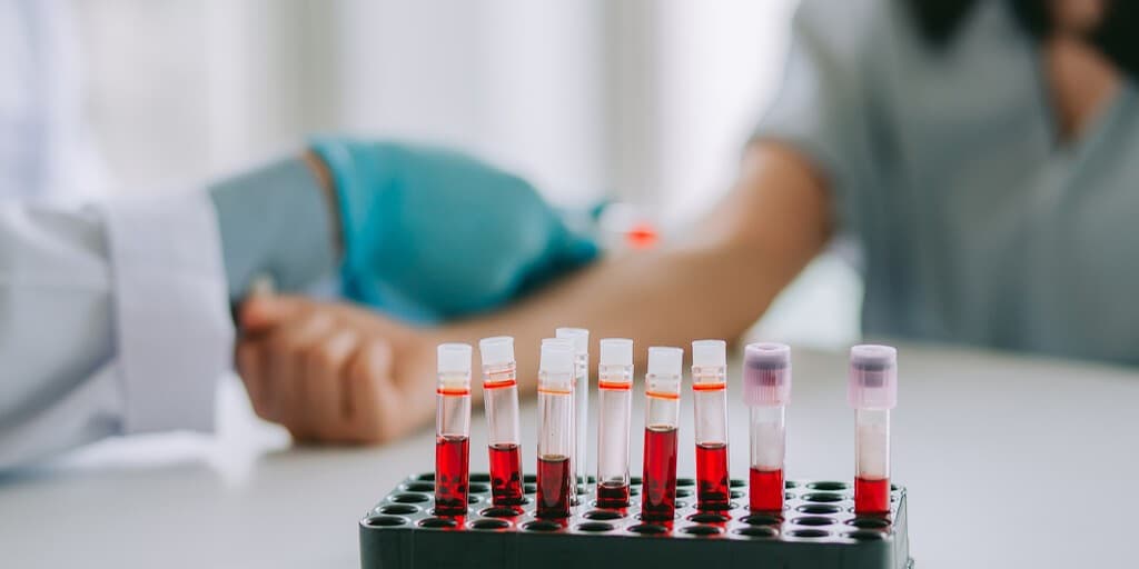 Limfocytoza