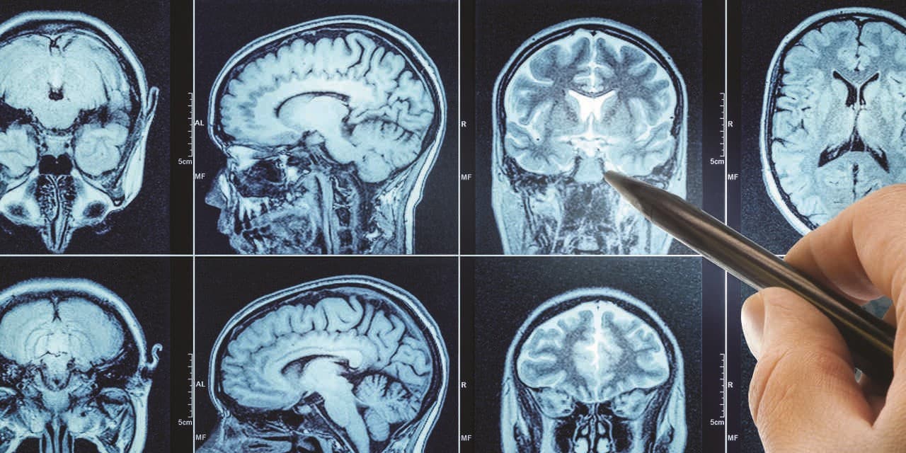 Neuroprzekaźniki