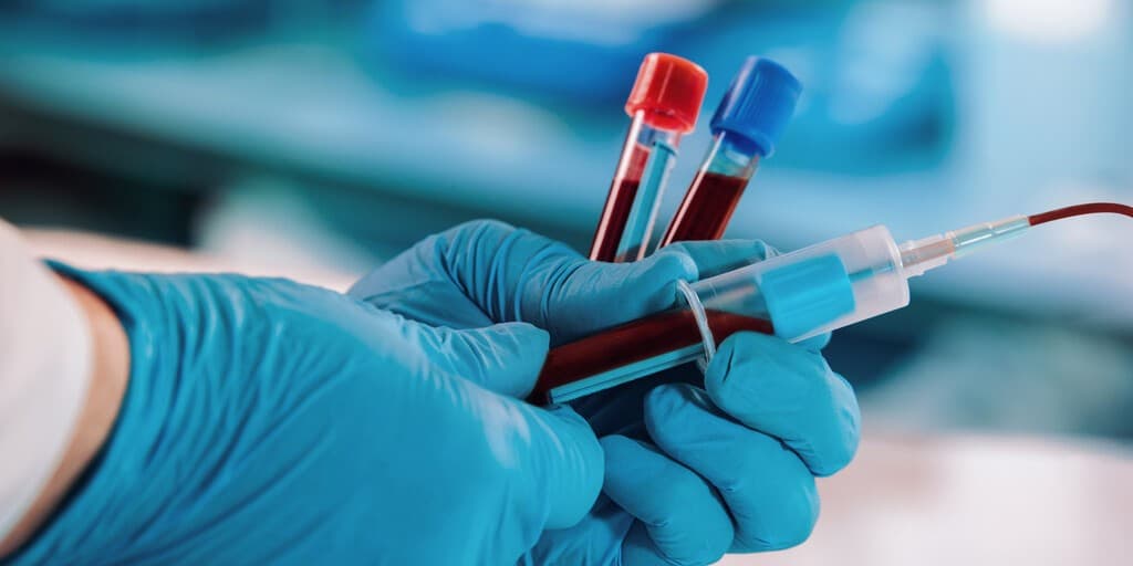 Immunoglobuliny
